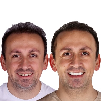 Cerrahi Diş Hekimliği - Tedavi 4