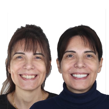 Diş Eti Tedavisi - Tedavi 10